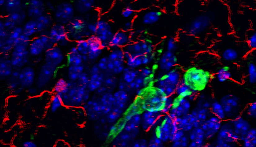 LCSB neuroinflammation